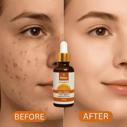 Relax UK Vitamin C Face Serum 30ml glow & balancing Skin Tone, Reducing Skin aging Reviews ⭐⭐⭐⭐⭐(FREE HOME DELIVERY) Multi Collection Online